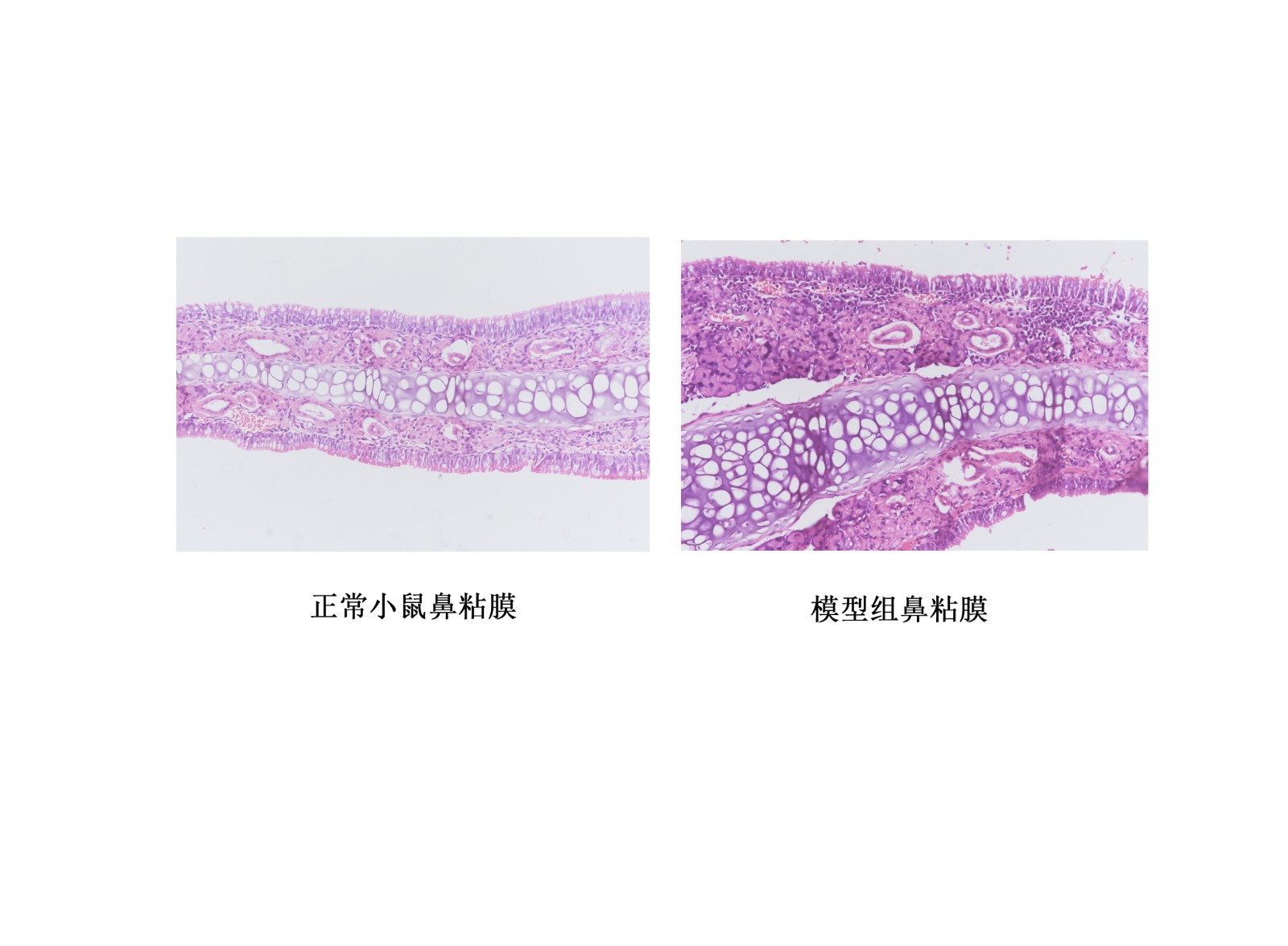 鼻粘膜的HE染色.jpg